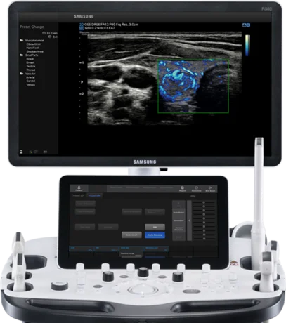 Samsung Medison RS85