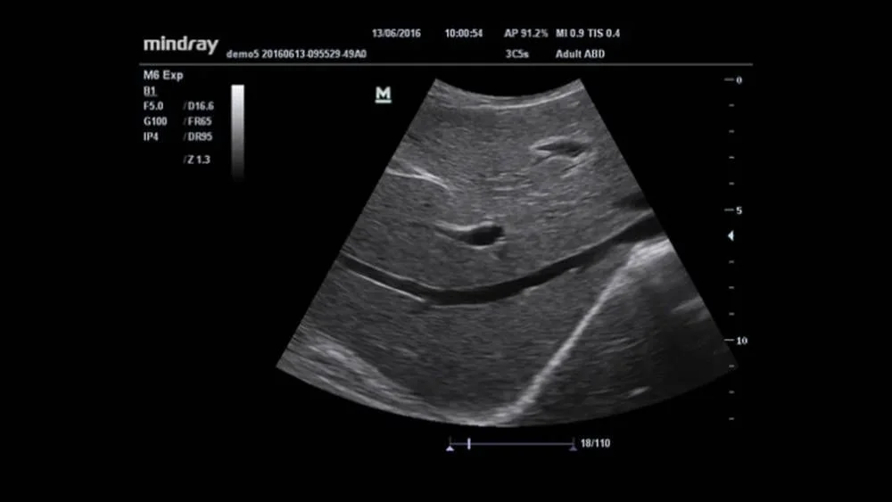 УЗИ аппарат Mindray M6 EXP
