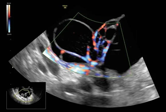 УЗИ аппарат General Electric Voluson E6