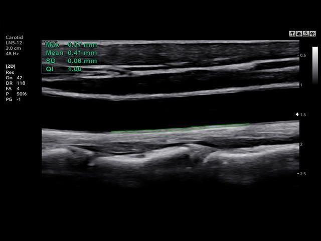 Samsung Medison HS30 Samsung Medison HS30