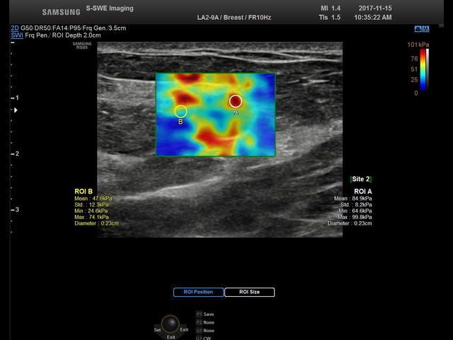 Samsung Medison RS85 Samsung Medison RS85