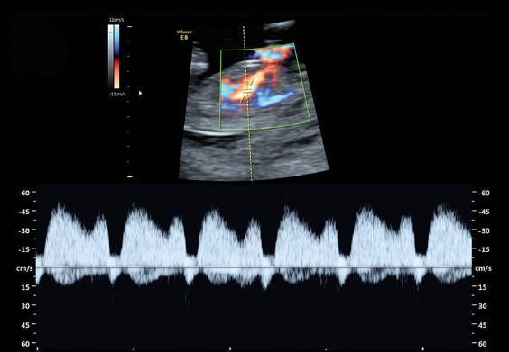 УЗИ аппарат General Electric Voluson E8