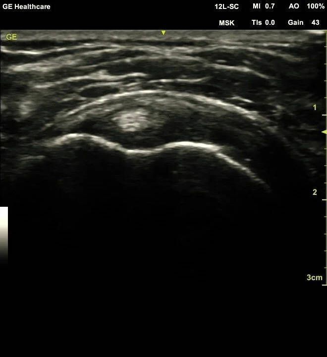 УЗИ аппарат General Electric Venue 50