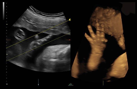 УЗИ аппарат General Electric Voluson E8