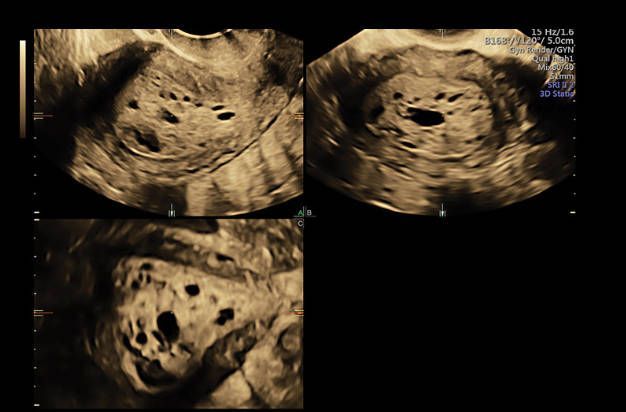 УЗИ аппарат General Electric Voluson E8