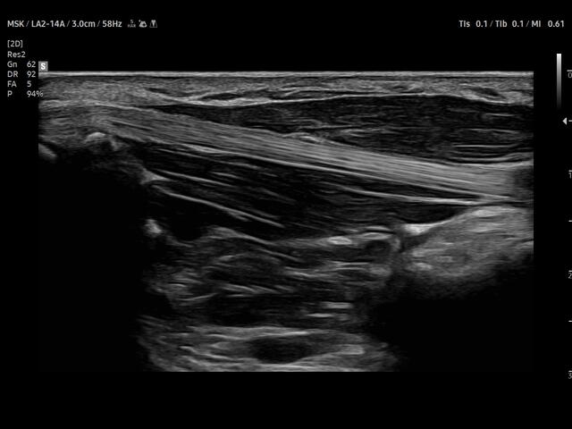 Samsung Medison V8 Samsung Medison V8