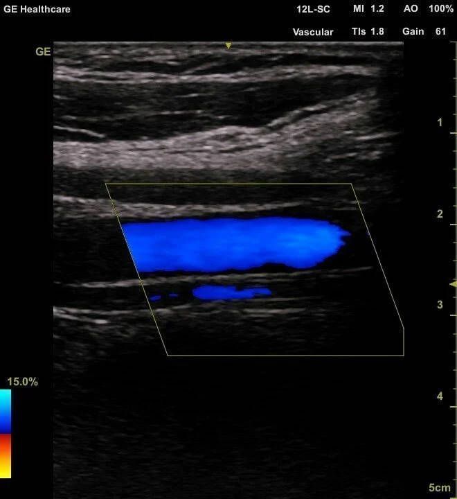 УЗИ аппарат General Electric Venue 50