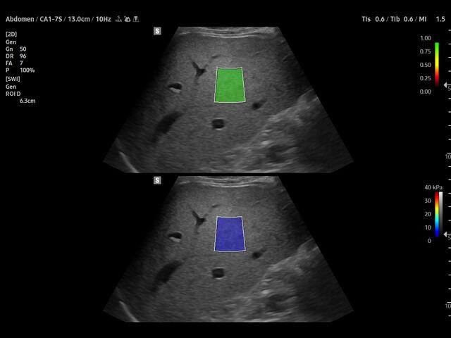 Samsung Medison V8 Samsung Medison V8
