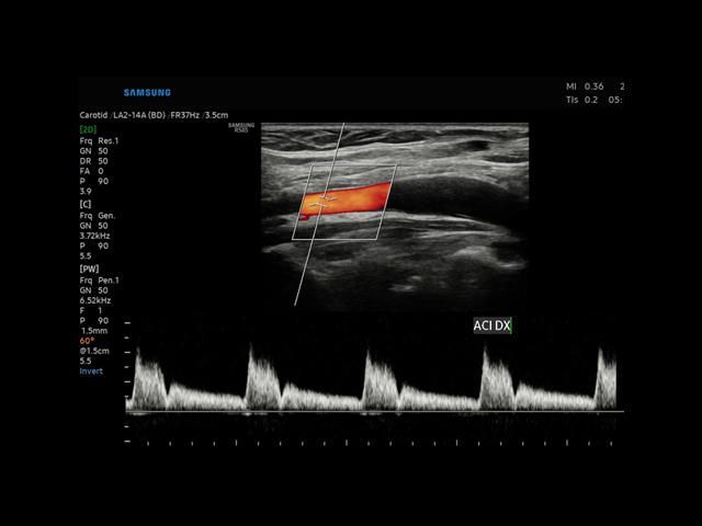 Samsung Medison RS85 Samsung Medison RS85