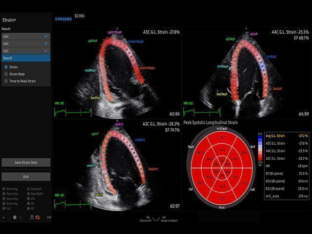 Samsung Medison V6 Samsung Medison V6