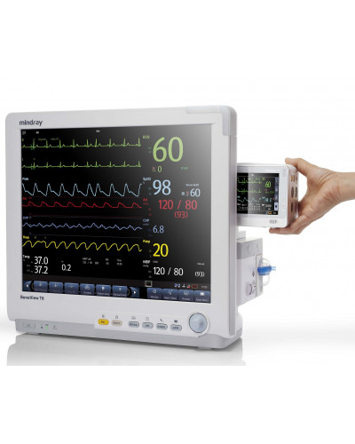 Монитор пациента прикроватный ipm 12