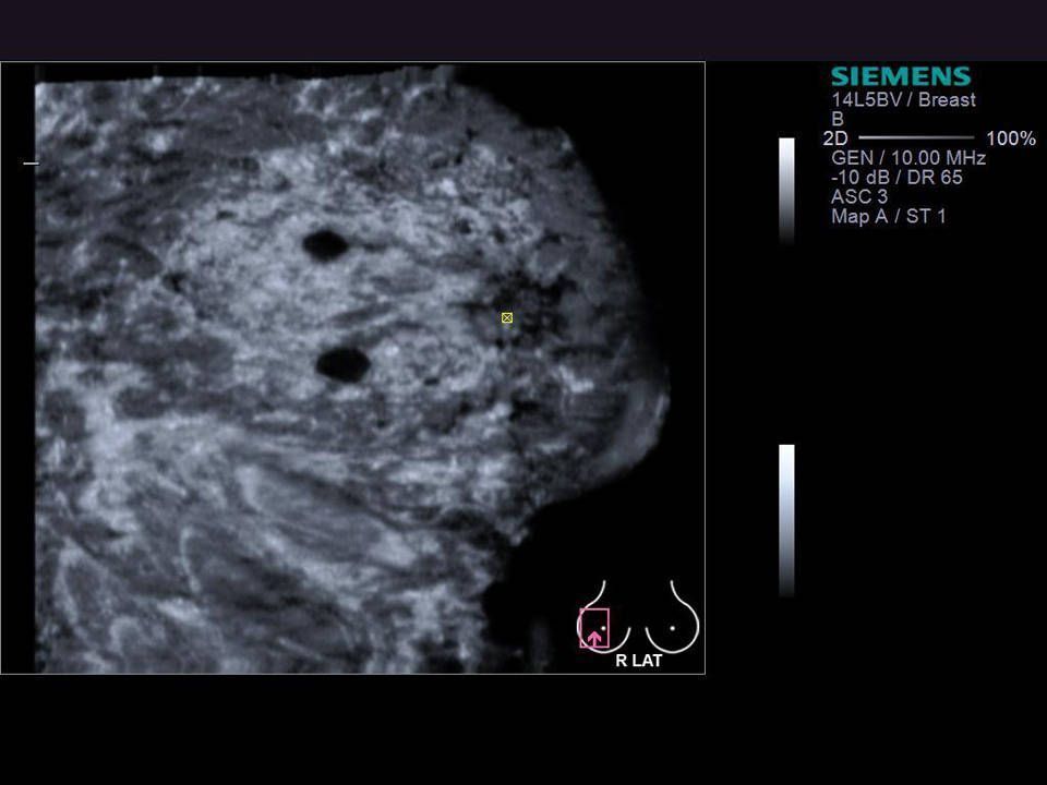 УЗИ аппарат Siemens ACUSON S2000