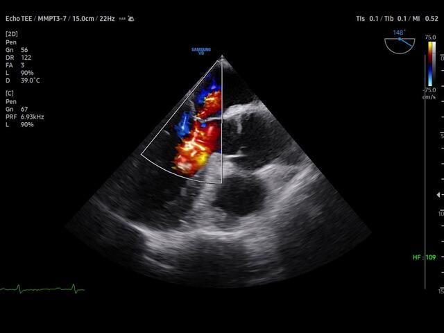 Samsung Medison V8 Samsung Medison V8