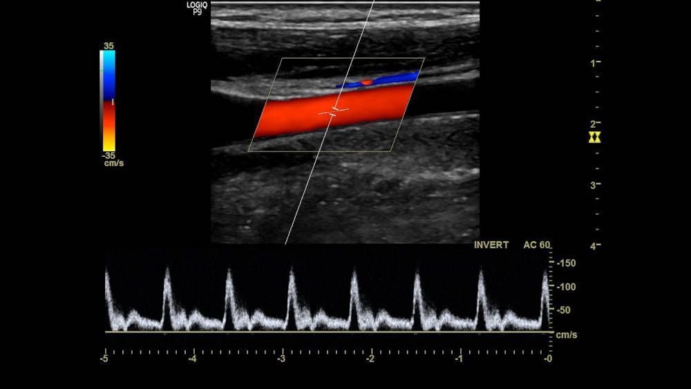 УЗИ аппарат General Electric Logiq P9