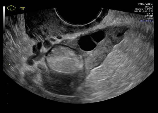УЗИ аппарат General Electric Voluson E8