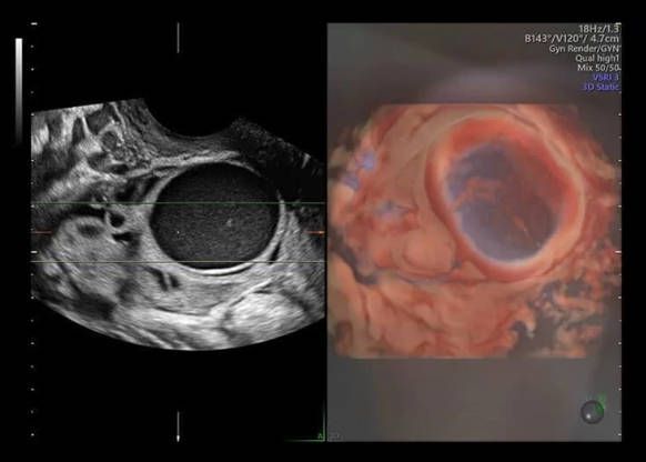 УЗИ аппарат General Electric Voluson E10