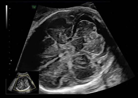 УЗИ аппарат General Electric Voluson E10