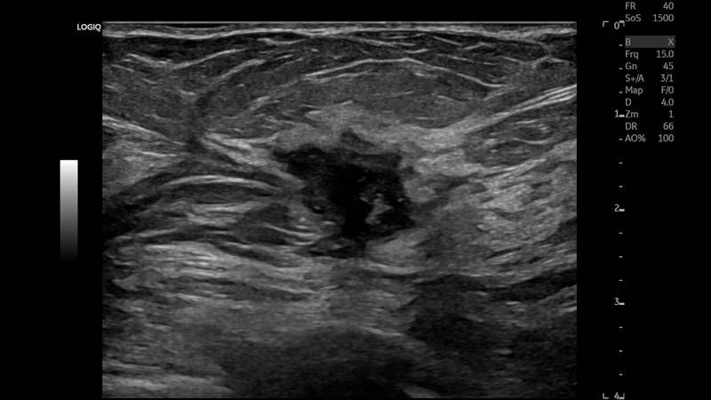 УЗИ аппарат General Electric Logiq E10