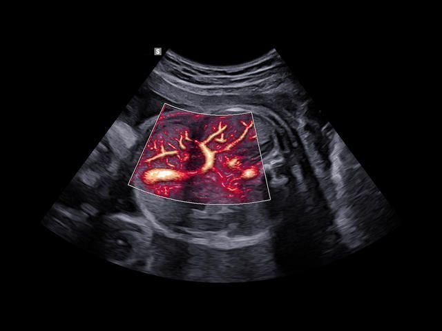 Samsung Medison W10 Samsung Medison W10