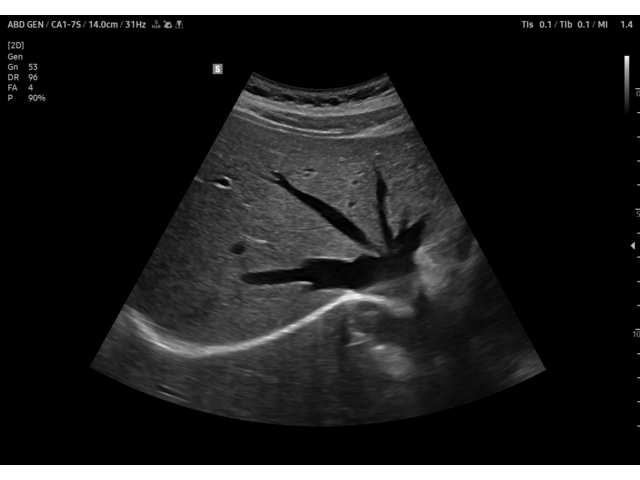 Samsung Medison V8 Samsung Medison V8