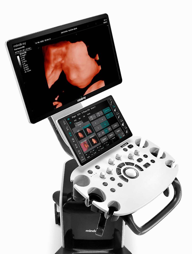 УЗИ аппарат Mindray Consona N6