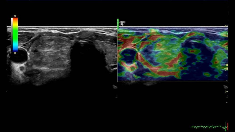 УЗИ аппарат General Electric Logiq P9