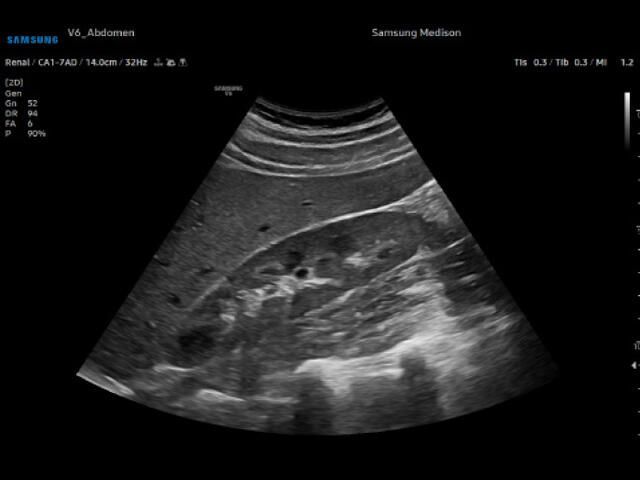 Samsung Medison V6 Samsung Medison V6