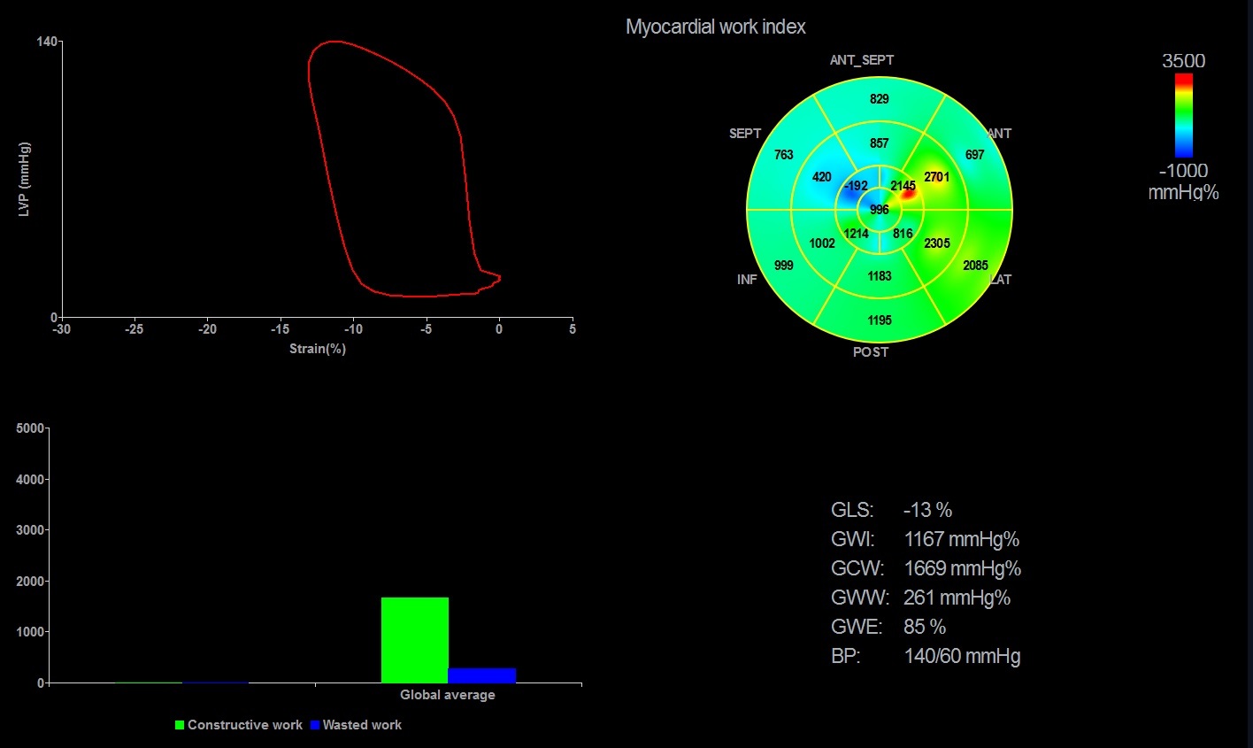 УЗИ аппарат General Electric Vivid E90