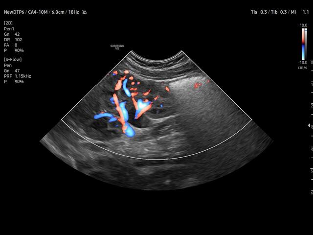 Samsung Medison V8 Samsung Medison V8