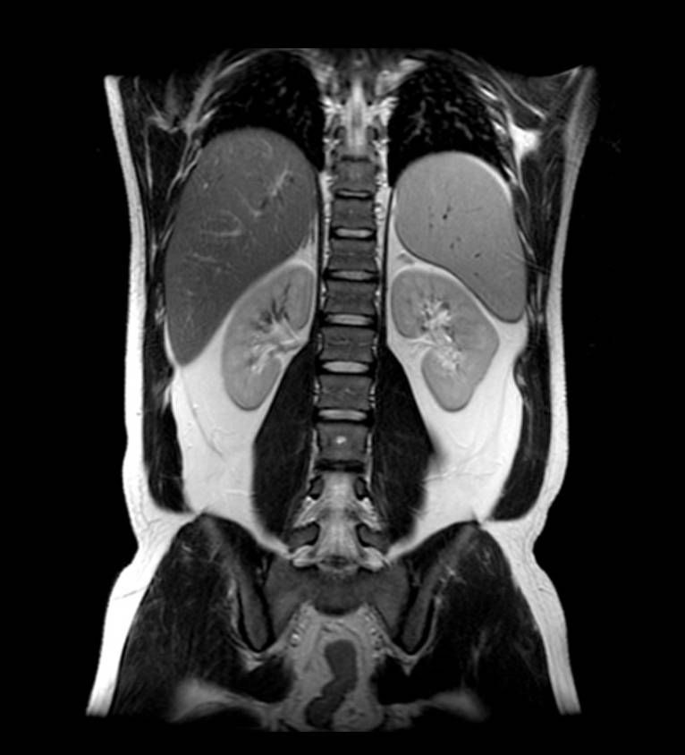 Аппарат МРТ General Electric SIGNA Explorer 1.5Т 60 см