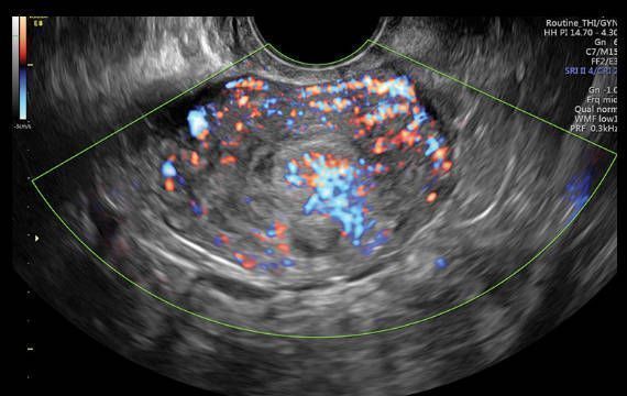 УЗИ аппарат General Electric Voluson E8