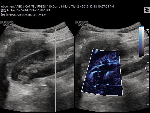 Samsung Medison RS85 Samsung Medison RS85