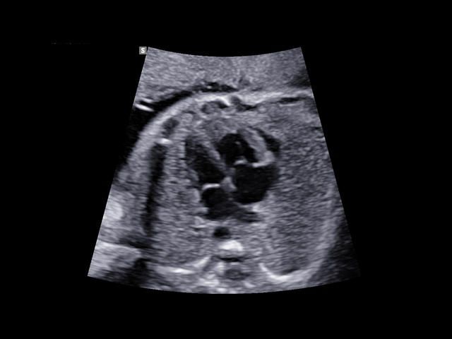 Samsung Medison W10 Samsung Medison W10