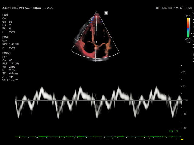 Samsung Medison V8 Samsung Medison V8