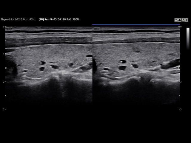 Samsung Medison HS30 Samsung Medison HS30