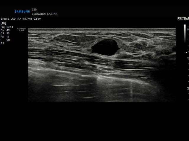 Samsung Medison RS85 Samsung Medison RS85