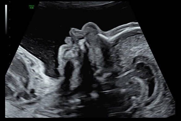 УЗИ аппарат General Electric Voluson E10