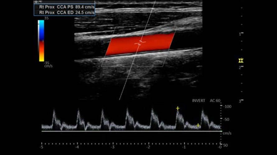 УЗИ аппарат General Electric Logiq P8