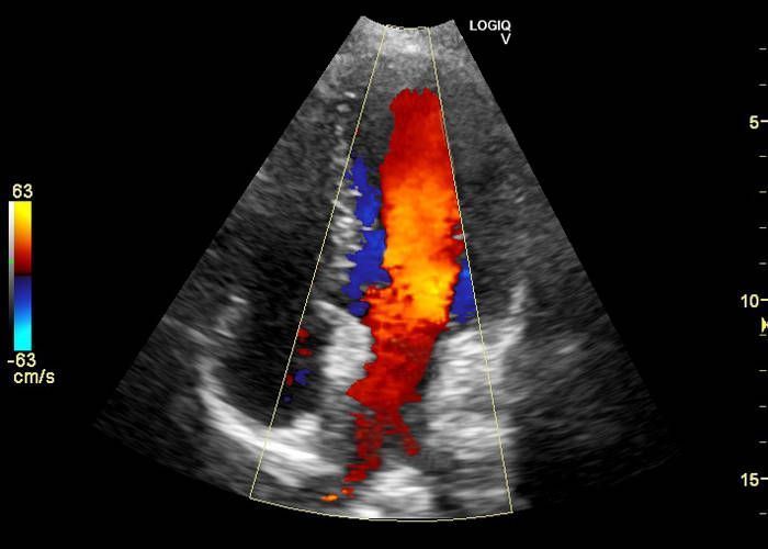 УЗИ аппарат General Electric Logiq V5
