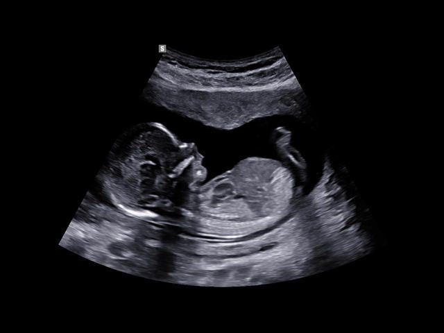 Samsung Medison W10 Samsung Medison W10