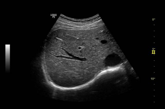 УЗИ аппарат General Electric Logiq P9