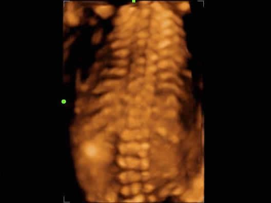 УЗИ Аппарат Mindray Z60