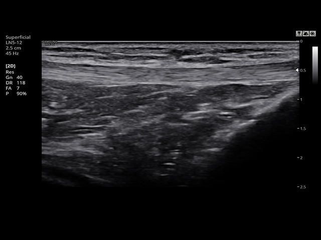 Samsung Medison HS30 Samsung Medison HS30