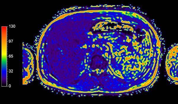Аппарат МРТ Philips Ingenia 1.5T