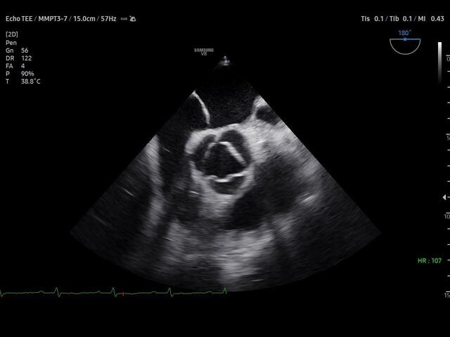 Samsung Medison V8 Samsung Medison V8