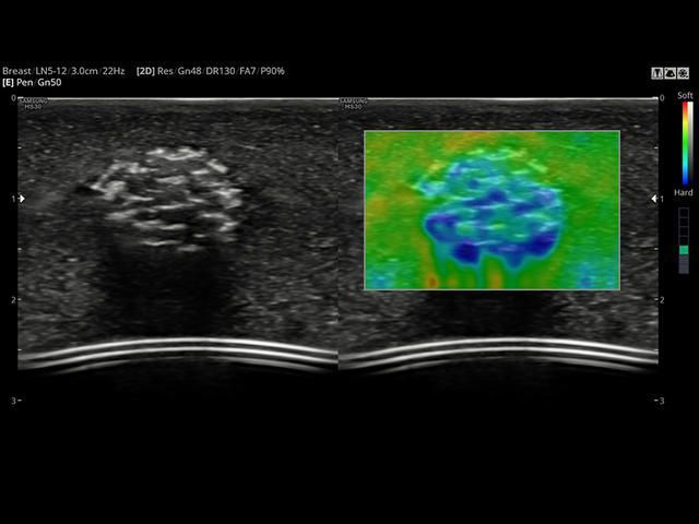 Samsung Medison HS30 Samsung Medison HS30