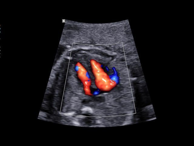 Samsung Medison W10 Samsung Medison W10