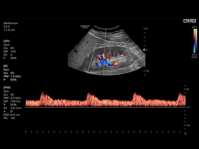 Samsung Medison HS30 Samsung Medison HS30