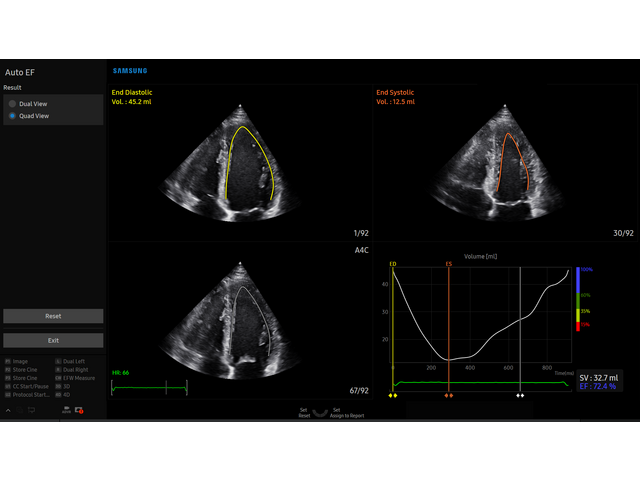 Samsung Medison V8 Samsung Medison V8
