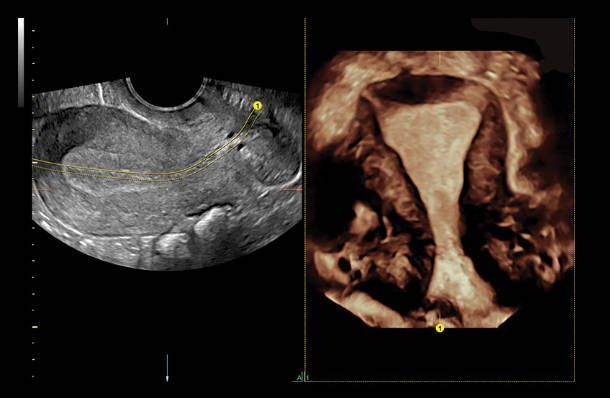 УЗИ аппарат General Electric Voluson E8